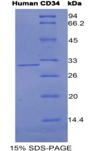 Human CD34 Protein (Recombinant His)