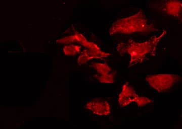 Polyclonal Rabbit anti-Human IKBKG / NEMO / IKK Gamma Antibody (phospho-Ser85, IF, WB)