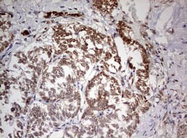 Monoclonal Mouse anti-Human TRIM24 / TIF1 Antibody (clone OTI2D9, aa706-1016, IHC, WB)