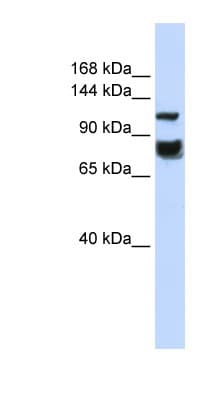 HDAC4 Antibody (aa540-589)