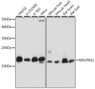 Polyclonal Rabbit anti-Human NDUFB11 Antibody (WB)