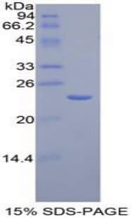 Mouse AGER / RAGE Protein (Recombinant His-T7)