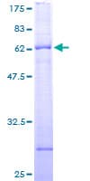 Human ARHGAP32 / RICS / p250GAP Protein (Recombinant GST)