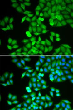 ARHGDIA / RHOGDI Antibody