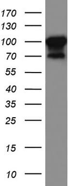 Monoclonal Mouse anti-Human MCAM / CD146 Antibody (clone UMAB154, Carrier-free, IHC, WB)