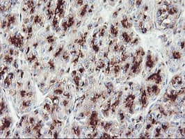 GOLM1 / GP73 / GOLPH2 Antibody (clone OTI2D6)