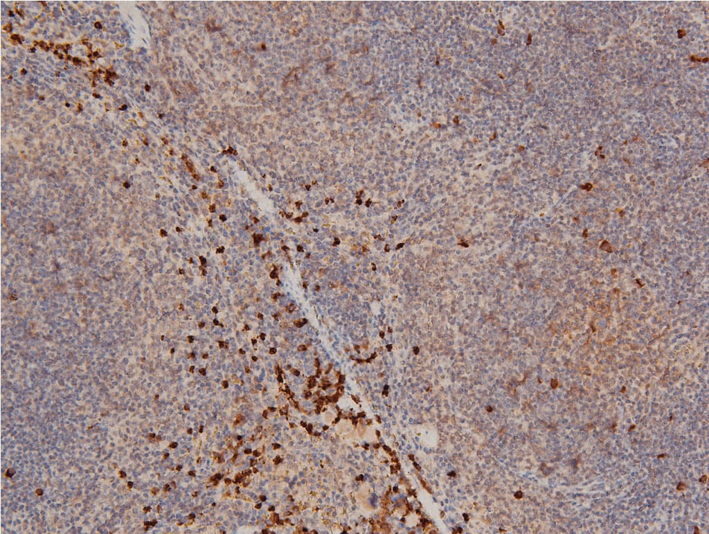 LIMK1 / LIMK Antibody (phospho-Thr508)