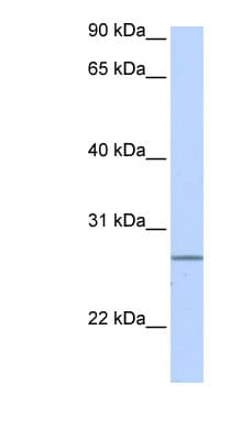 Polyclonal Rabbit anti-Human GRPEL2 Antibody (C-Terminus, WB)