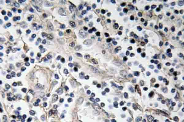 Polyclonal Rabbit anti-Human BMP7 Antibody (Glu173, IHC, WB)