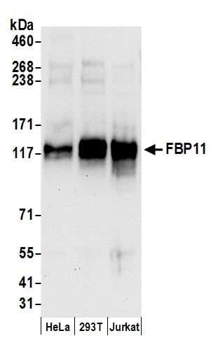 Polyclonal Rabbit anti-Human PRPF40A / FNBP3 Antibody (aa275-325, WB)