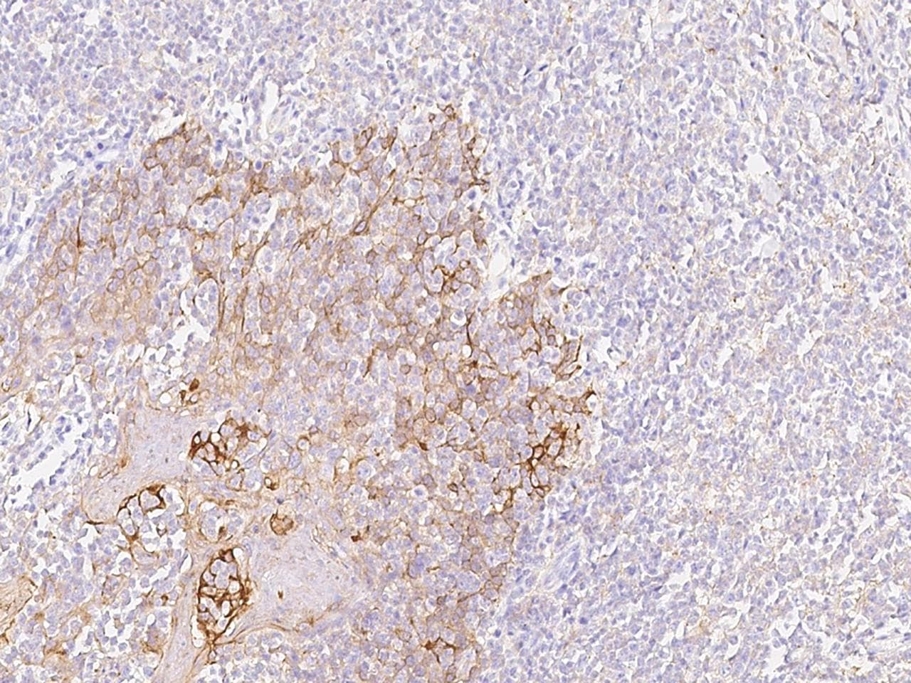 KRT76 / Keratin 76 Antibody