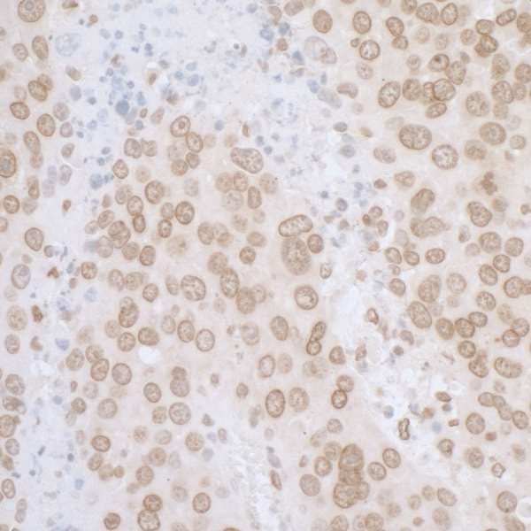TMPO / TP / Thymopoietin Antibody (aa1-50)