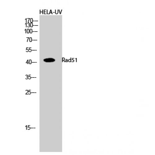 Polyclonal Rabbit anti-Human RAD51 / RECA Antibody (250-330 aa, IHC, WB)