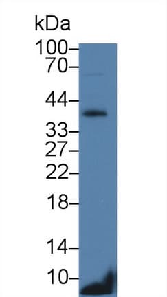 CD79B / CD79 Beta Antibody (aa26-225)