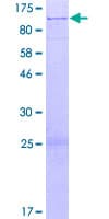 Human PNPLA8 Protein (Recombinant GST)