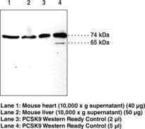 PCSK9 Antibody