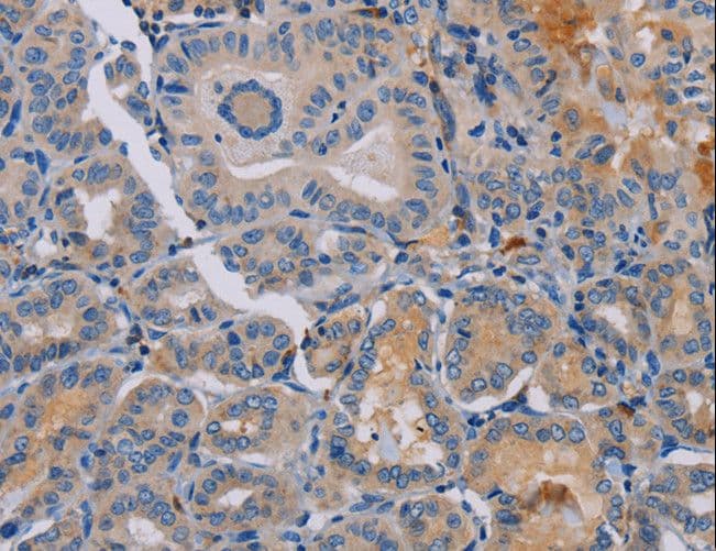 Polyclonal Rabbit anti-Human Peptide YY / PYY Antibody (IHC)