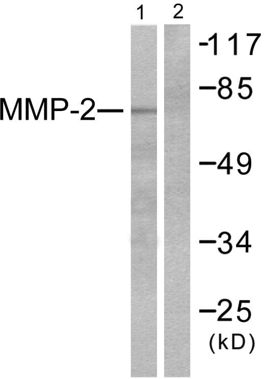 Polyclonal Rabbit anti-Human MMP2 Antibody (WB)