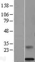 MSMB / MSP Protein (Over-Expression Lysate Myc-DDK (Flag))