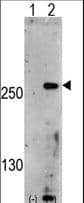 PIKFYVE / PIP5K Antibody (aa1531-1561)