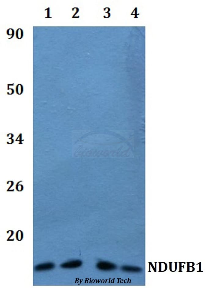 Polyclonal Rabbit anti-Human NDUFB1 / MNLL Antibody (WB)