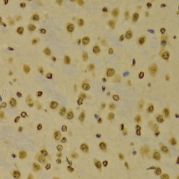 Histone H3 Antibody (Tri-Methyl-Lys9)
