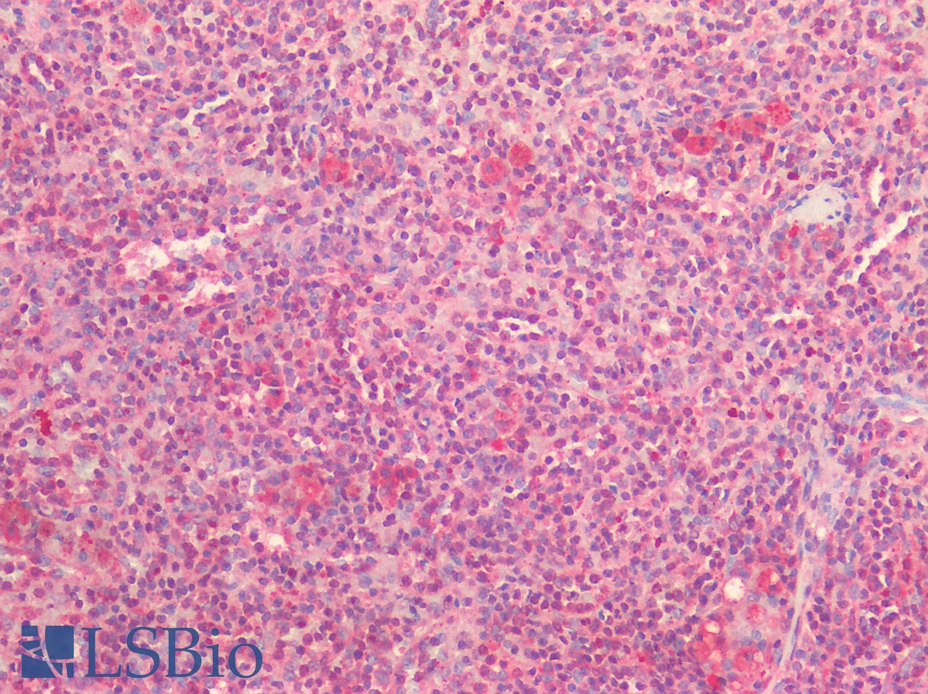 IHC-plus™ PDGFRA / PDGFR Alpha Antibody