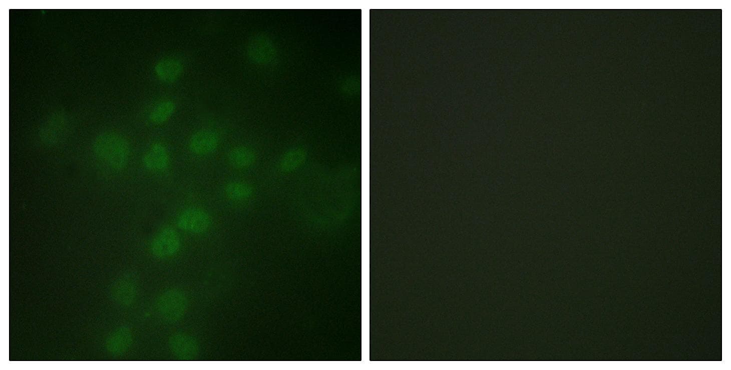 Polyclonal Rabbit anti-Human TERT / Telomerase Antibody (phospho-Ser227, IF)