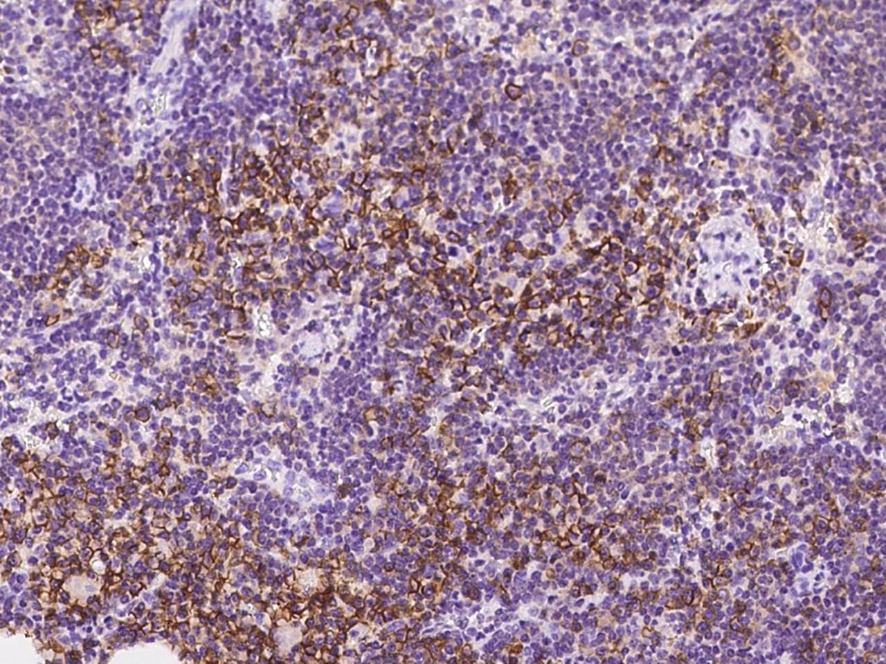 SLC1A4 / ASCT1 Antibody