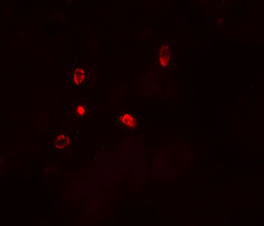 Polyclonal Rabbit anti-Human ATG4D Antibody (IHC, IF, WB)