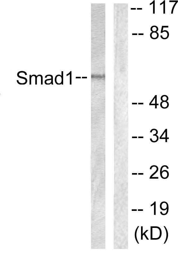 SMAD1 Antibody (p187)