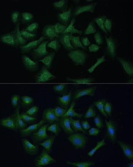 REXO2 Antibody