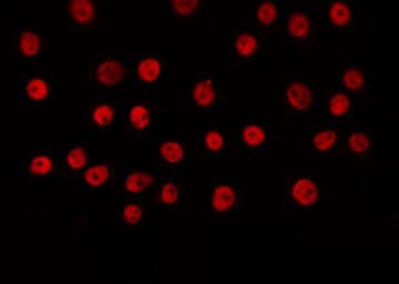 POU2F2 / OCT2 Antibody