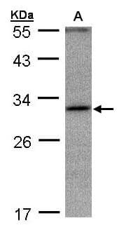 Polyclonal Rabbit anti-Human ANKRD45 Antibody (aa74-282, IHC, WB)