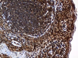 PAI-RBP1 / SERBP1 Antibody (clone OTI5G2)