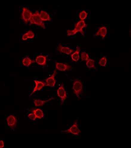 Polyclonal Rabbit anti-Human c-Kit / CD117 Antibody (IHC, IF, WB)