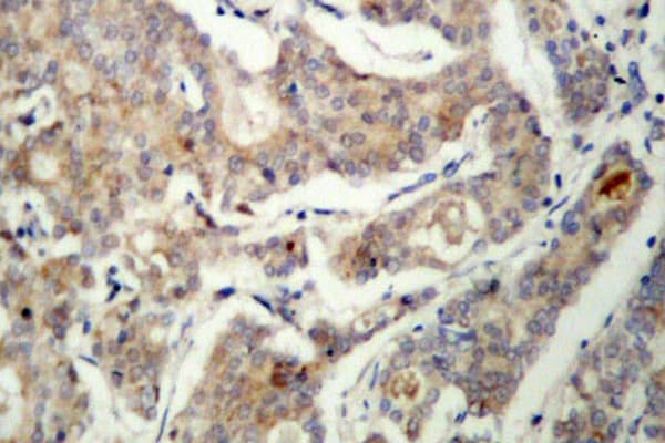 BAD Antibody (Arg149)