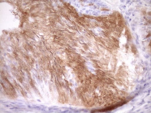 p16INK4a / CDKN2A Antibody (clone OTI1H3)