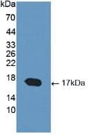 COMP / THBS5 Antibody (aa123-240)
