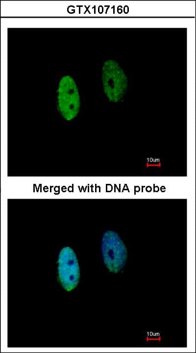 DENND1B Antibody (aa1-272)