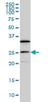 Monoclonal Mouse anti-Human DCAKD Antibody (clone 3E4, IF, WB)
