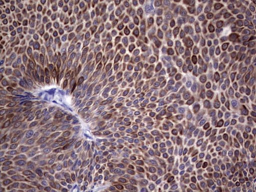 KRT19 / CK19 / Cytokeratin 19 Antibody (aa240-390, clone OTI1A8)