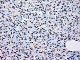 BRAF / B-Raf Antibody (clone OTI4A5)