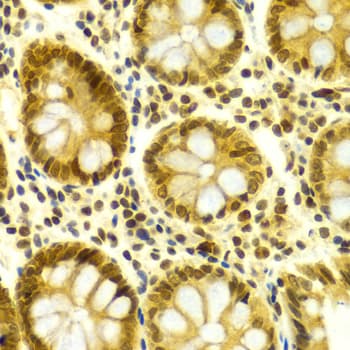 ELAVL1 / HUR Antibody