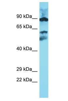 METTL16 / METT10D Antibody (aa277-326)