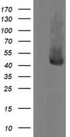 MAP2K1 / MKK1 / MEK1 Antibody (clone OTI4E4)