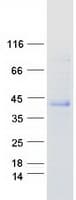 Human CHODL / Chondrolectin Protein (Recombinant Myc-DDK (Flag))