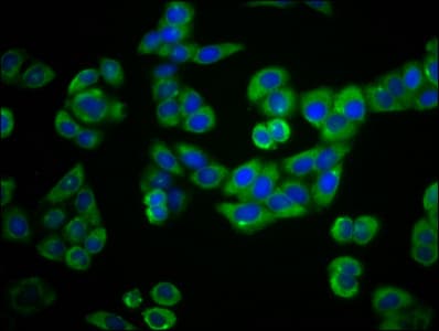 Polyclonal Rabbit anti-Human PLEKHG5 Antibody (IF)
