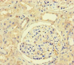 Polyclonal Rabbit anti-Human MLH1 Antibody (IHC, IF, WB)