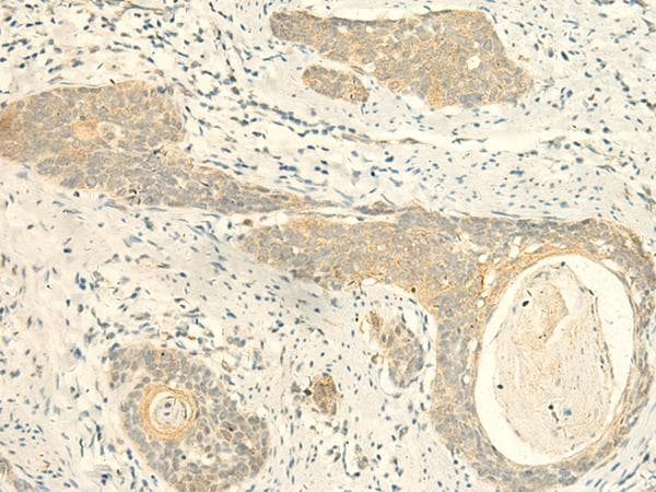 Polyclonal Rabbit anti-Human MPV17 Antibody (IHC)